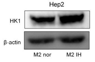 Representative Western blot images showing HK1 protein levels.jpg